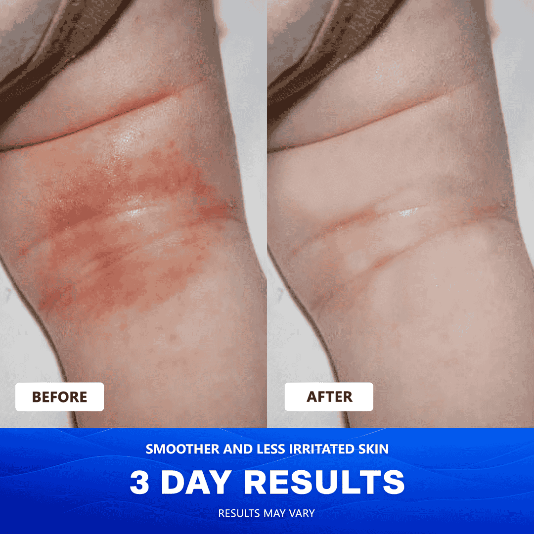 Uvora Eczema-Relief Ocean Blend