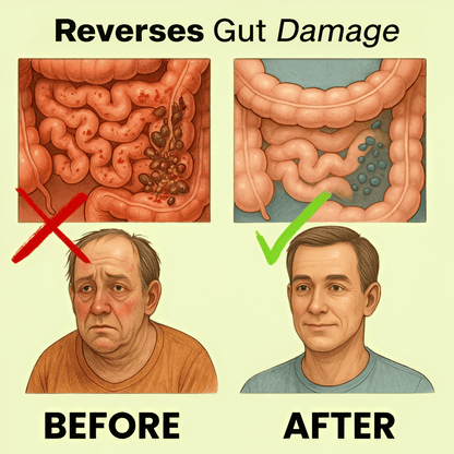 Uvora - Milk Thistle Parasite Detox