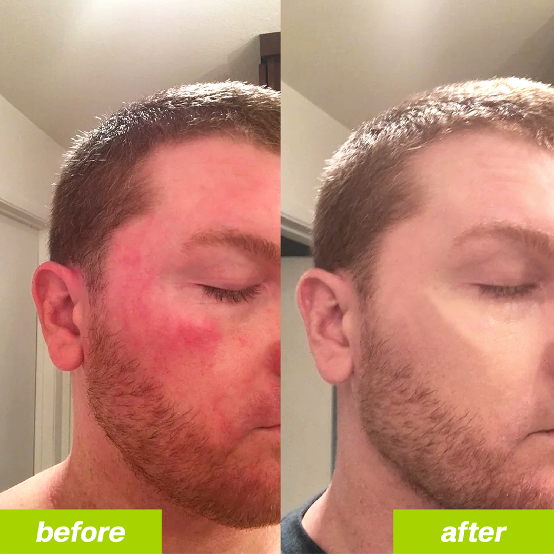 Uvora - Milk Thistle Detox 2.0