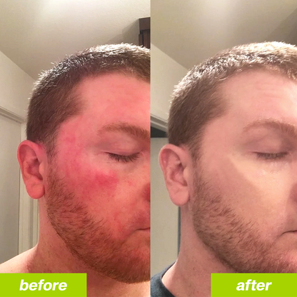 Uvora - Milk Thistle Detox 2.0 Buy 1 (Subscribe & Save)