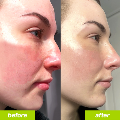 Uvora - Milk Thistle Detox 2.0